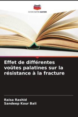 Effet de différentes voûtes palatines sur la résistance à la fracture