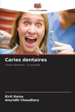 Caries dentaires