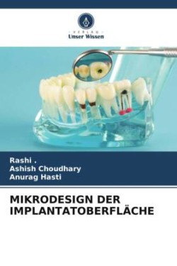 MIKRODESIGN DER IMPLANTATOBERFLÄCHE