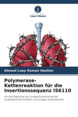 Polymerase-Kettenreaktion für die Insertionssequenz IS6110