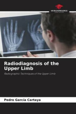 Radiodiagnosis of the Upper Limb