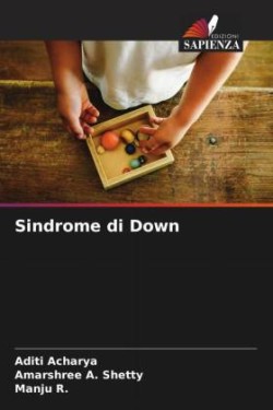 Sindrome di Down