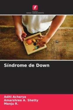 Síndrome de Down