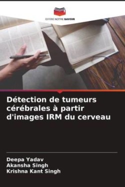 Détection de tumeurs cérébrales à partir d'images IRM du cerveau