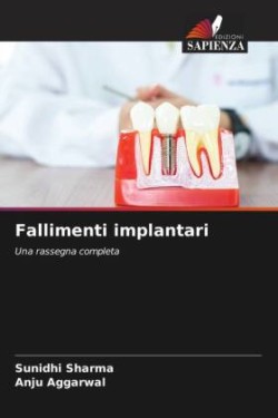 Fallimenti implantari