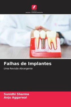 Falhas de Implantes