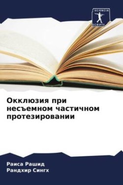 Окклюзия при несъемном частичном протези