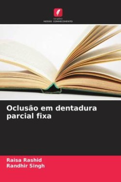 Oclusão em dentadura parcial fixa