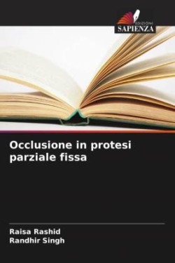 Occlusione in protesi parziale fissa