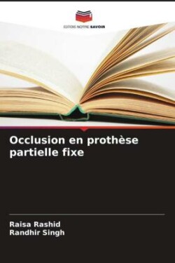 Occlusion en prothèse partielle fixe