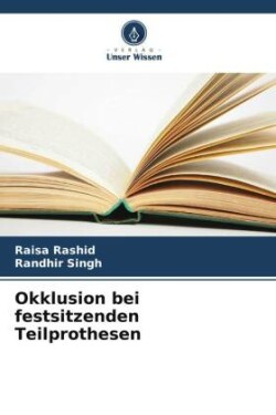 Okklusion bei festsitzenden Teilprothesen