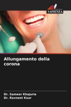 Allungamento della corona