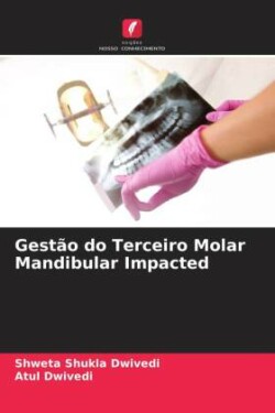 Gestão do Terceiro Molar Mandibular Impacted