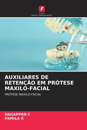 Auxiliares de Retenção Em Prótese Maxilo-Facial