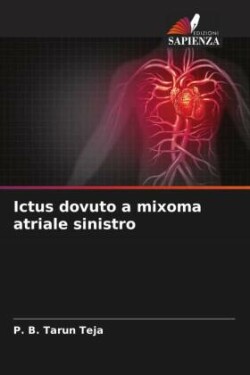 Ictus dovuto a mixoma atriale sinistro