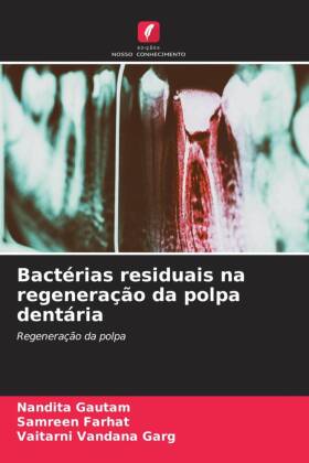 Bactérias residuais na regeneração da polpa dentária