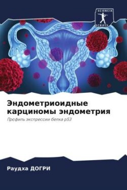 Эндометриоидные карциномы эндометрия