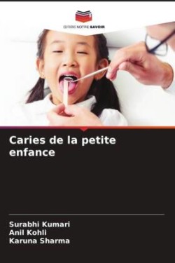 Caries de la petite enfance