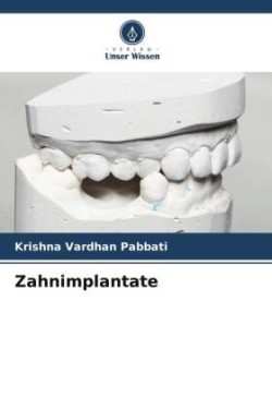 Zahnimplantate