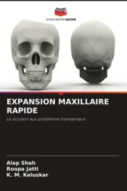 Expansion Maxillaire Rapide