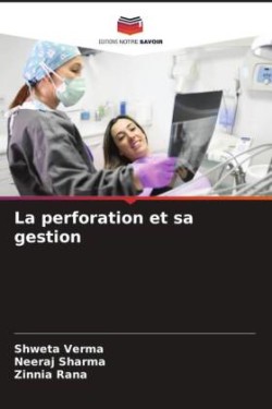 perforation et sa gestion