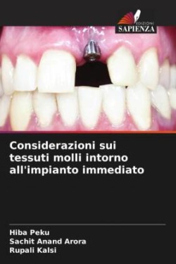 Considerazioni sui tessuti molli intorno all'impianto immediato