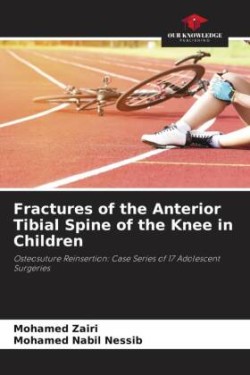 Fractures of the Anterior Tibial Spine of the Knee in Children