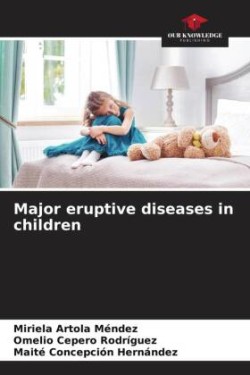 Major eruptive diseases in children