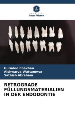 Retrograde Füllungsmaterialien in Der Endodontie