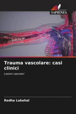 Trauma vascolare