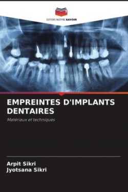 Empreintes d'Implants Dentaires