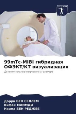 99mTc-MIBI гибридная ОФЭКТ/КТ визуализация