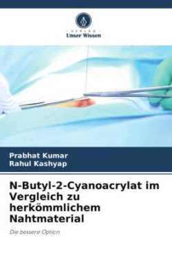 N-Butyl-2-Cyanoacrylat im Vergleich zu herkömmlichem Nahtmaterial