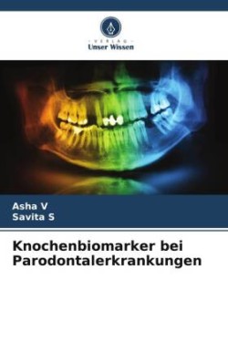 Knochenbiomarker bei Parodontalerkrankungen