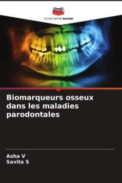 Biomarqueurs osseux dans les maladies parodontales