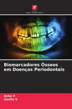 Biomarcadores Ósseos em Doenças Periodontais