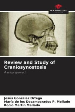 Review and Study of Craniosynostosis