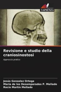 Revisione e studio della craniosinostosi