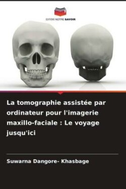 La tomographie assistée par ordinateur pour l'imagerie maxillo-faciale : Le voyage jusqu'ici