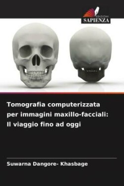 Tomografia computerizzata per immagini maxillo-facciali: Il viaggio fino ad oggi