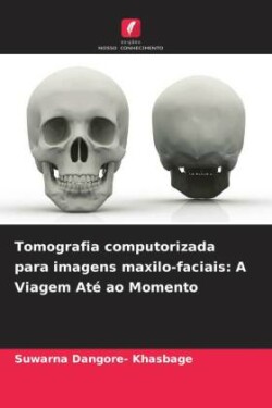 Tomografia computorizada para imagens maxilo-faciais: A Viagem Até ao Momento