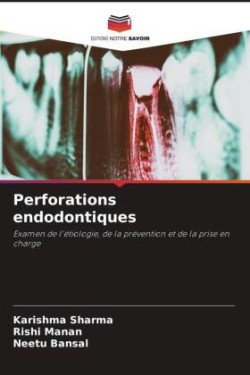 Perforations endodontiques