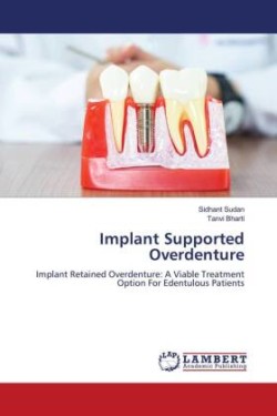 Implant Supported Overdenture