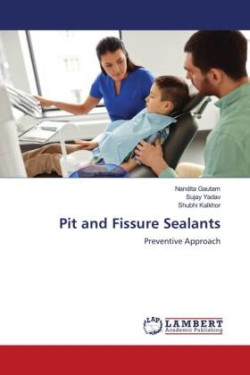 Pit and Fissure Sealants