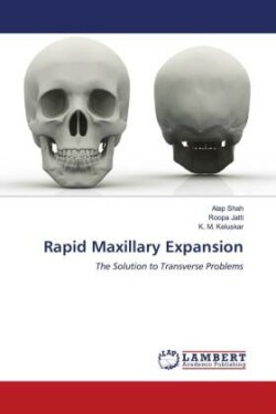 Rapid Maxillary Expansion