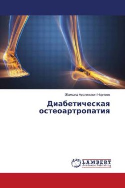 Diabeticheskaq osteoartropatiq