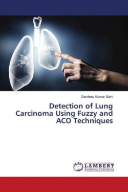 Detection of Lung Carcinoma Using Fuzzy and ACO Techniques