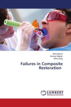 Failures in Composite Restoration