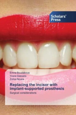 Replacing the incisor with implant-supported prosthesis