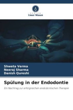 Spülung in der Endodontie